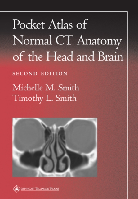 Pocket Atlas of Normal CT Anatomy of the Head and Brain, Paperback / softback Book