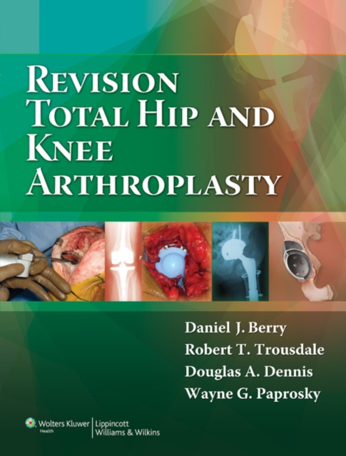 Revision Total Hip and Knee Arthroplasty, Hardback Book