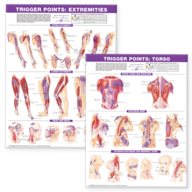 Trigger Point Chart Set: Torso & Extremities Paper, Wallchart Book