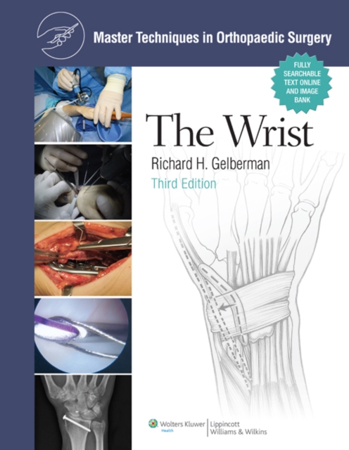 Master Techniques in Orthopaedic Surgery: The Wrist, Hardback Book