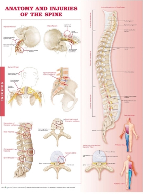 Anatomy and Injuries of the Spine Anatomical Chart, Wallchart Book