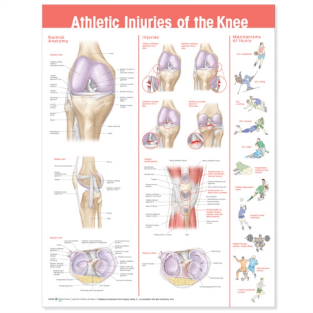 Athletic Injuries of the Knee Anatomical Chart, Wallchart Book