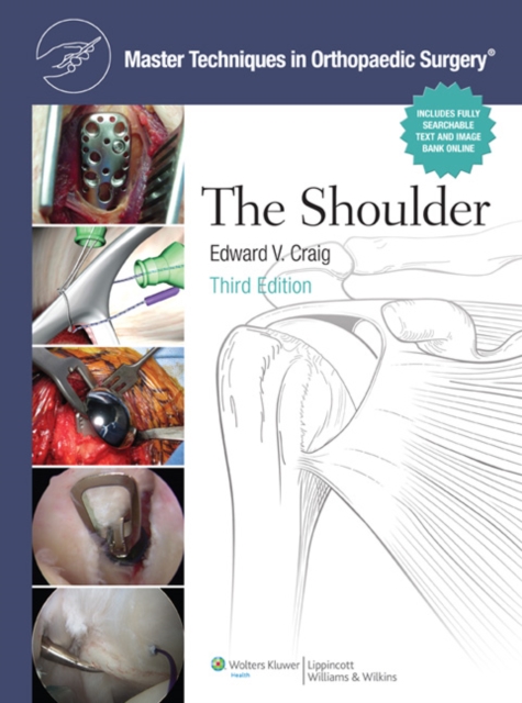 Master Techniques in Orthopaedic Surgery: Shoulder, Hardback Book