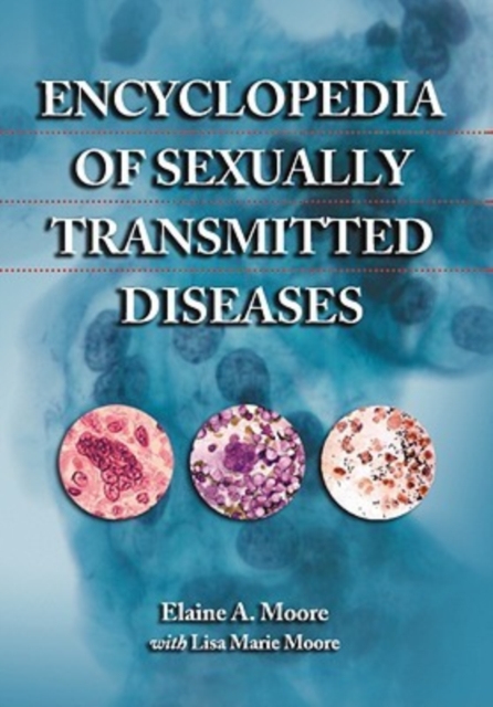 Encyclopedia of Sexually Transmitted Diseases, Paperback / softback Book