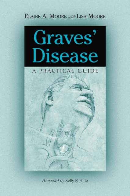 Graves' Disease : A Practical Guide, EPUB eBook