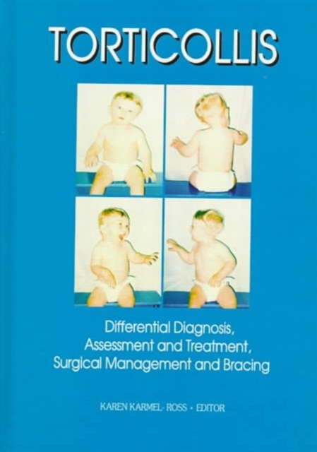 Torticollis : Differential Diagnosis, Assessment and Treatment, Surgical Management and Bracing, Hardback Book