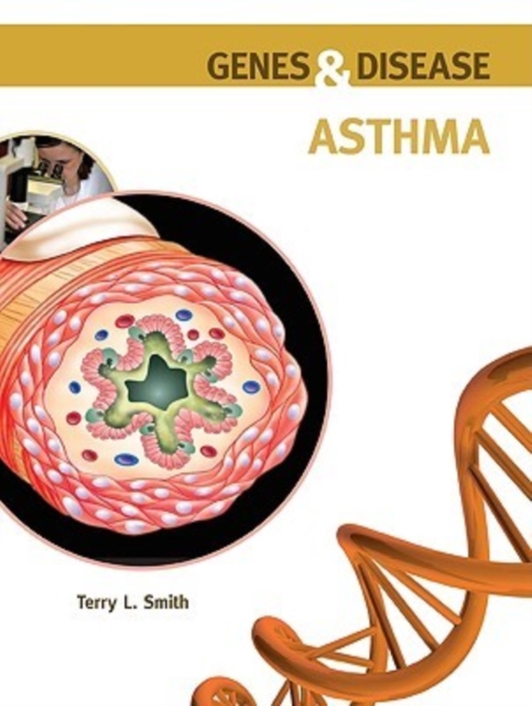 Asthma, Hardback Book