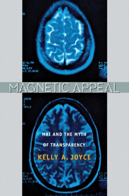 Magnetic Appeal : MRI and the Myth of Transparency, Hardback Book