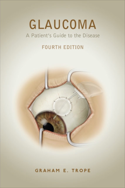 Glaucoma : A Patient's Guide to the Disease, Fourth Edition, Paperback / softback Book