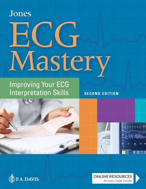 ECG Mastery : Improving Your ECG Interpretation Skills, Paperback / softback Book