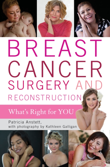 Breast Cancer Surgery and Reconstruction : What's Right For You, Paperback / softback Book