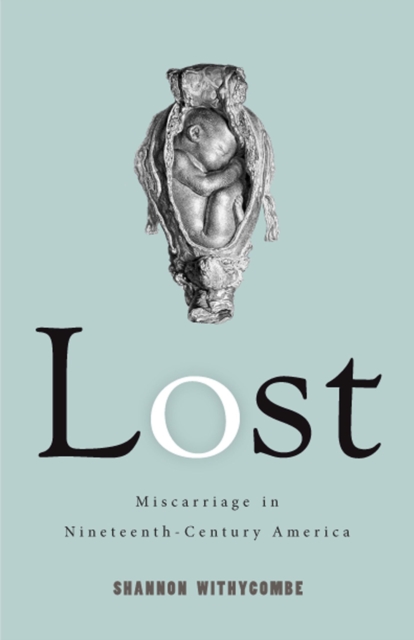 Lost : Miscarriage in Nineteenth-Century America, Paperback / softback Book
