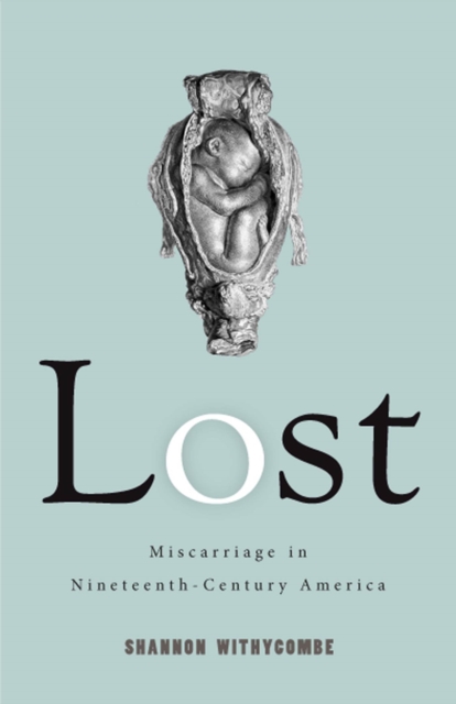 Lost : Miscarriage in Nineteenth-Century America, Hardback Book
