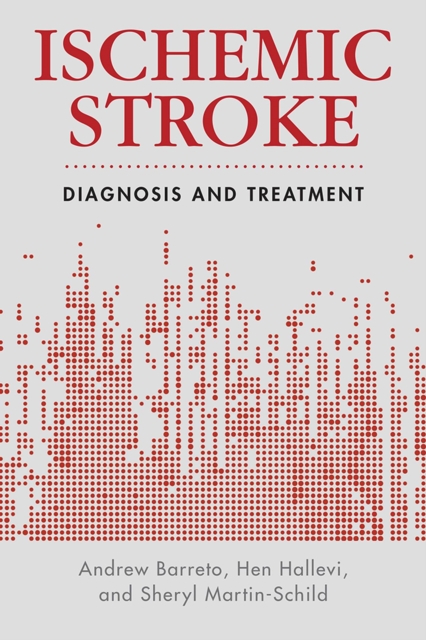 Ischemic Stroke : Diagnosis and Treatment, Paperback / softback Book