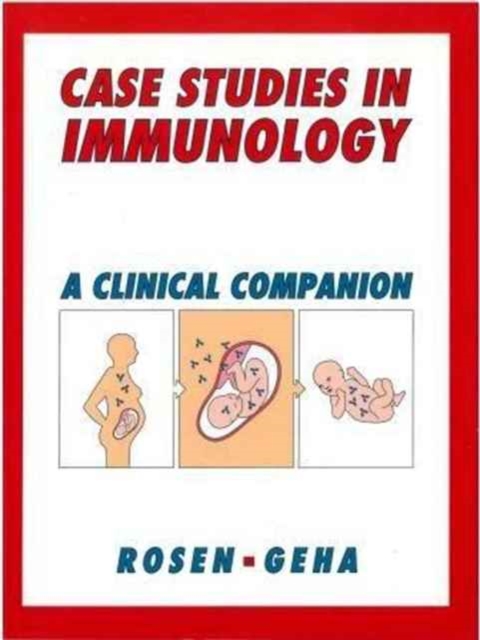 Clinical Cases in Immunology : A Clinical Companion, Paperback / softback Book