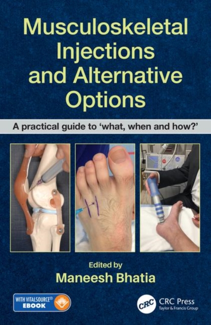 Musculoskeletal Injections and Alternative Options : A practical guide to 'what, when and how?', Paperback / softback Book