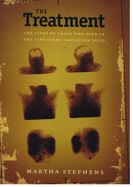 The Treatment : The Story of Those Who Died in the Cincinnati Radiation Tests, Hardback Book