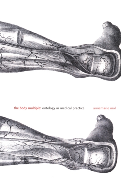 The Body Multiple : Ontology in Medical Practice, Hardback Book