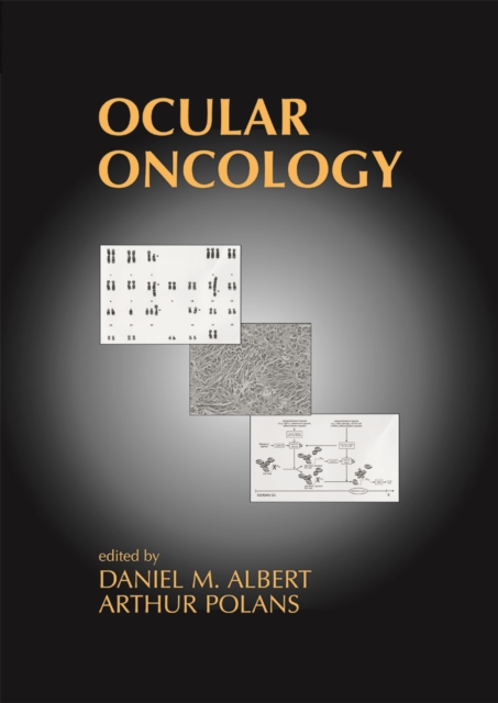 Ocular Oncology, PDF eBook