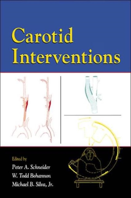 Carotid Interventions, Hardback Book
