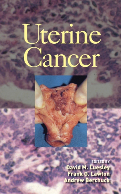 Uterine Cancer, Hardback Book