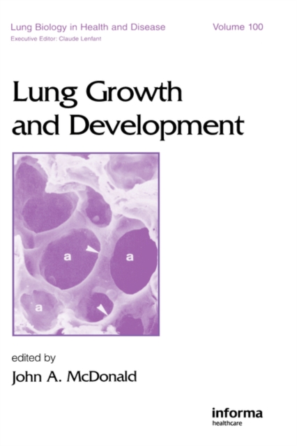 Lung Growth and Development, Hardback Book