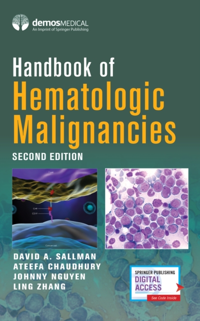 Handbook of Hematologic Malignancies, Paperback / softback Book