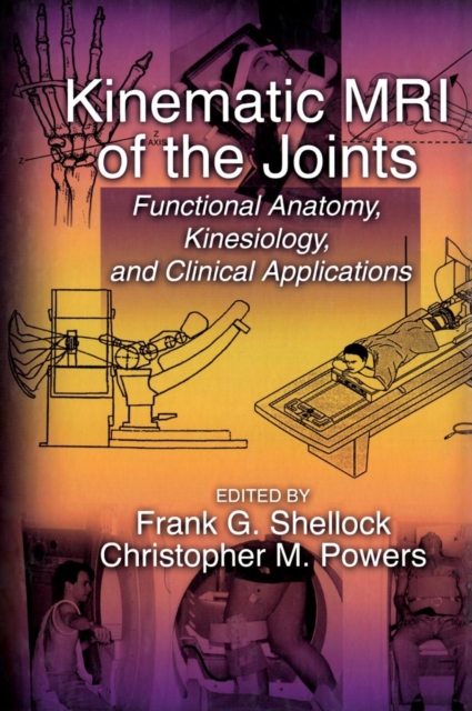 Kinematic MRI of the Joints : Functional Anatomy, Kinesiology, and Clinical Applications, Hardback Book