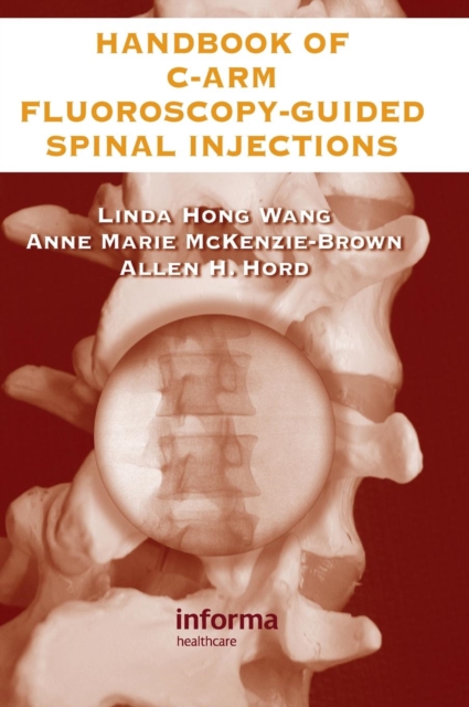 The Handbook of C-Arm Fluoroscopy-Guided Spinal Injections, Hardback Book