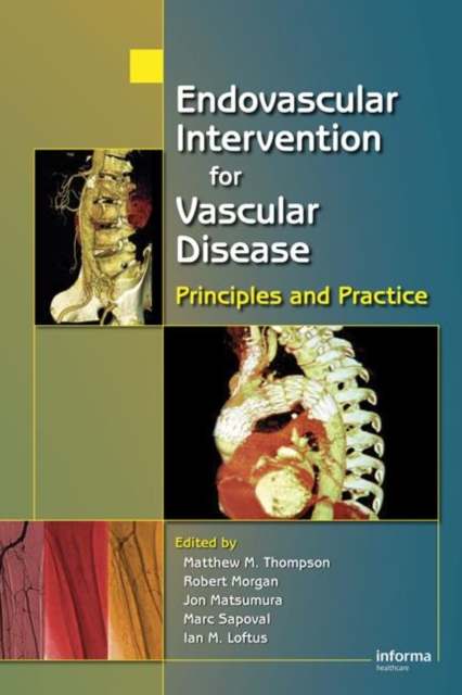 Endovascular Intervention for Vascular Disease : Principles and Practice, Hardback Book