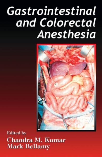 Gastrointestinal and Colorectal Anesthesia, Hardback Book