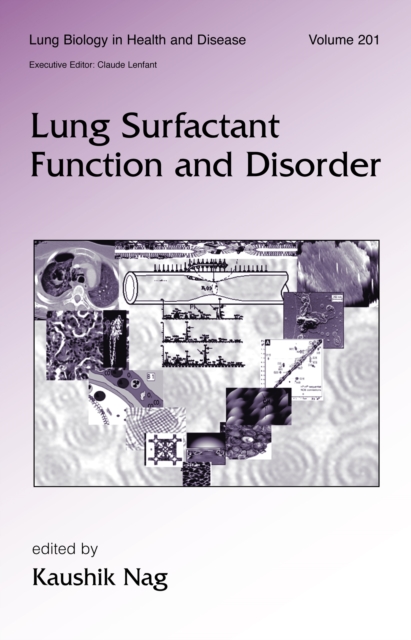 Lung Surfactant Function and Disorder, PDF eBook