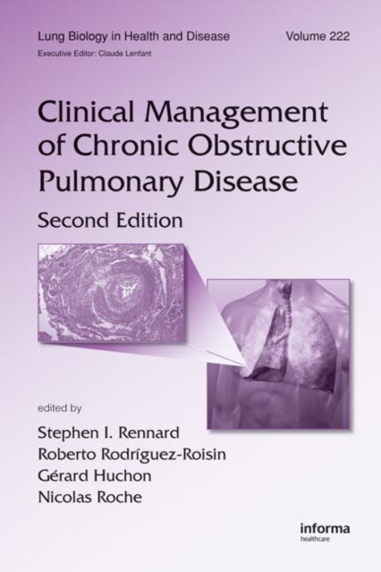 Clinical Management of Chronic Obstructive Pulmonary Disease, Hardback Book