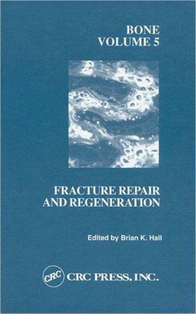 Bone, Volume V : A Treatise, Hardback Book