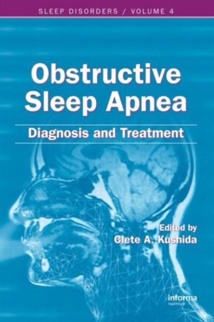 Obstructive Sleep Apnea : Diagnosis and Treatment, Hardback Book