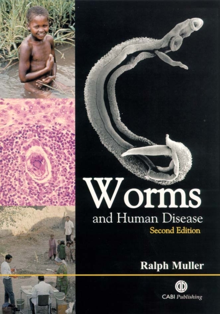 Worms and Human Disease, Paperback / softback Book