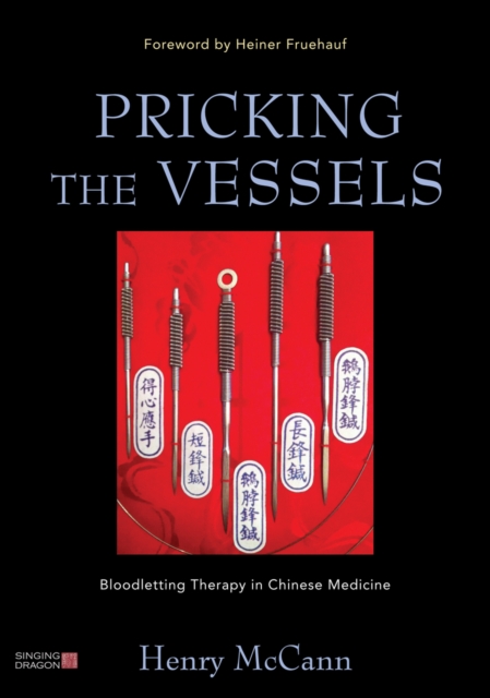Pricking the Vessels : Bloodletting Therapy in Chinese Medicine, EPUB eBook