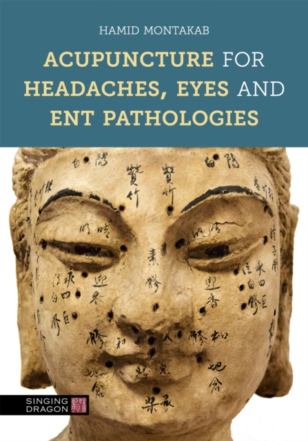 Acupuncture for Headaches, Eyes and ENT Pathologies, Hardback Book