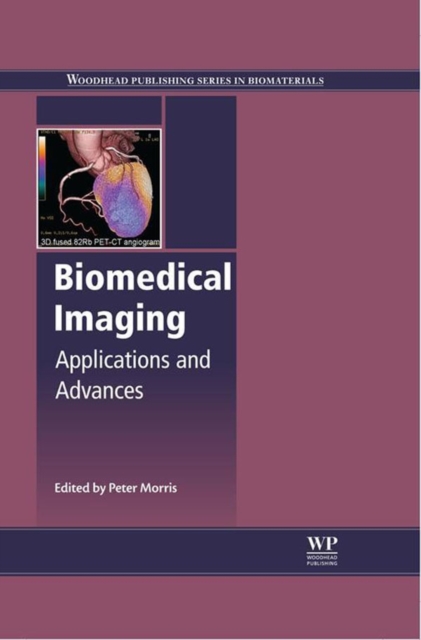 Biomedical Imaging : Applications and Advances, EPUB eBook