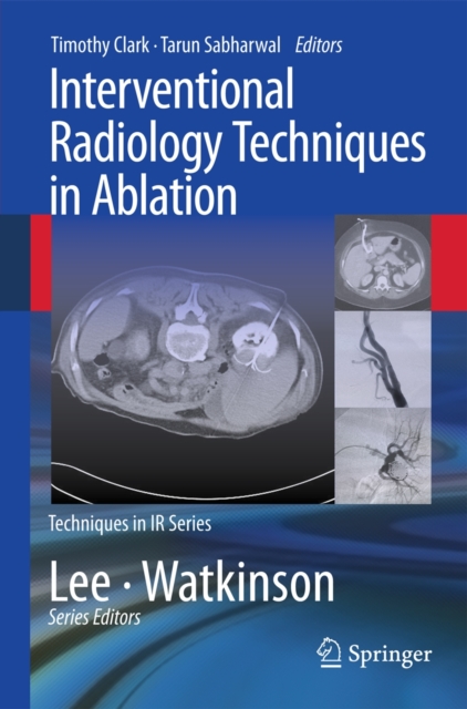 Interventional Radiology Techniques in Ablation, Paperback / softback Book