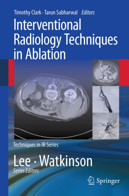 Interventional Radiology Techniques in Ablation, PDF eBook