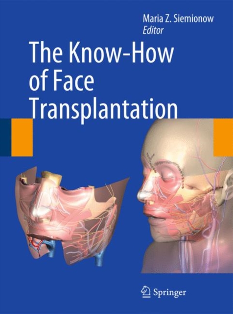 The Know-How of Face Transplantation, Hardback Book