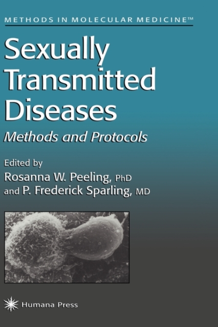 Sexually Transmitted Diseases, Hardback Book