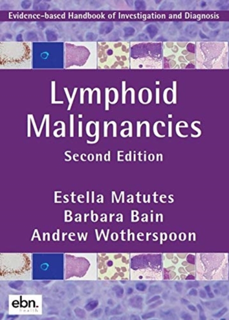 Lymphoid Malignancies : Evidence-based Handbook of Investigation and Diagnosis, Paperback / softback Book