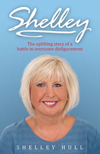 SHELLEY : The uplifting story of a battle to overcome disfigurement, Paperback / softback Book