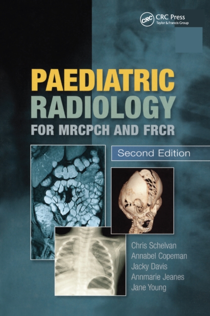 Paediatric Radiology for MRCPCH and FRCR, Second Edition, PDF eBook
