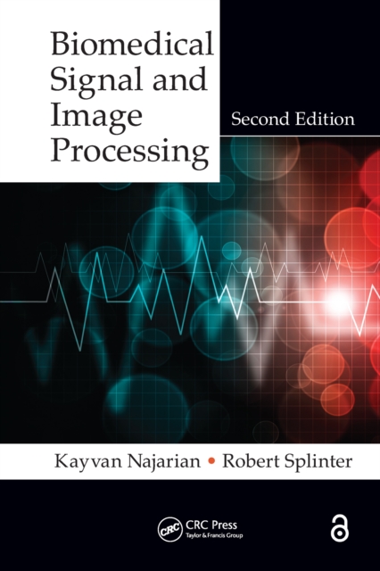 Biomedical Signal and Image Processing, EPUB eBook