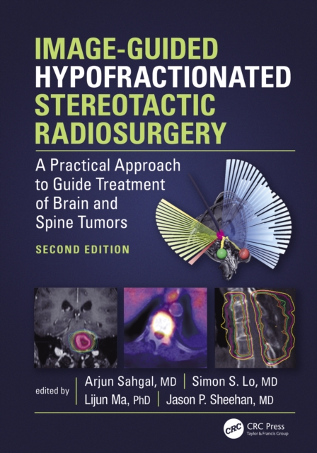 Image-Guided Hypofractionated Stereotactic Radiosurgery : A Practical Approach to Guide Treatment of Brain and Spine Tumors, PDF eBook