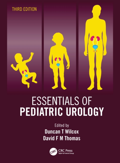 Essentials of Pediatric Urology, EPUB eBook