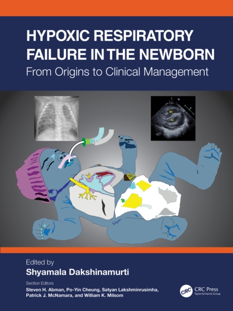 Hypoxic Respiratory Failure in the Newborn : From Origins to Clinical Management, EPUB eBook